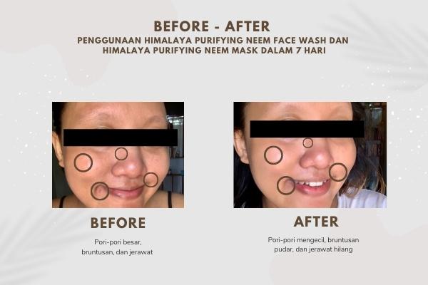 review himalaya neem face wash dan neem face mask